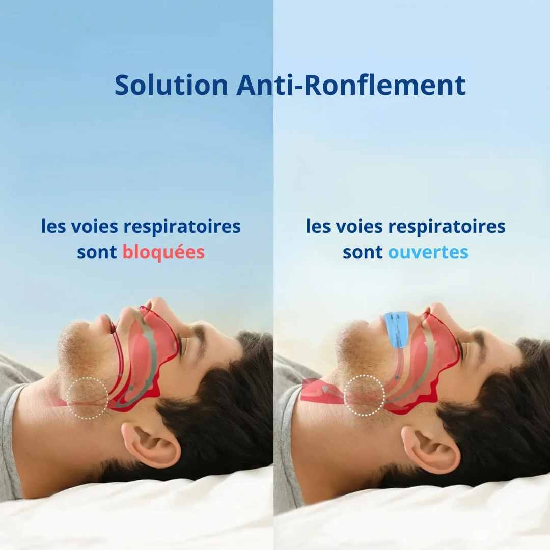 Dispositif Nasal Réutilisable – Sommeil Silencieux dès la Première Nuit