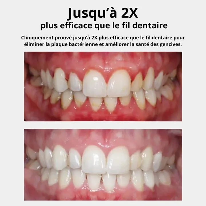 Hydropulseur Dentaire Rechargeable